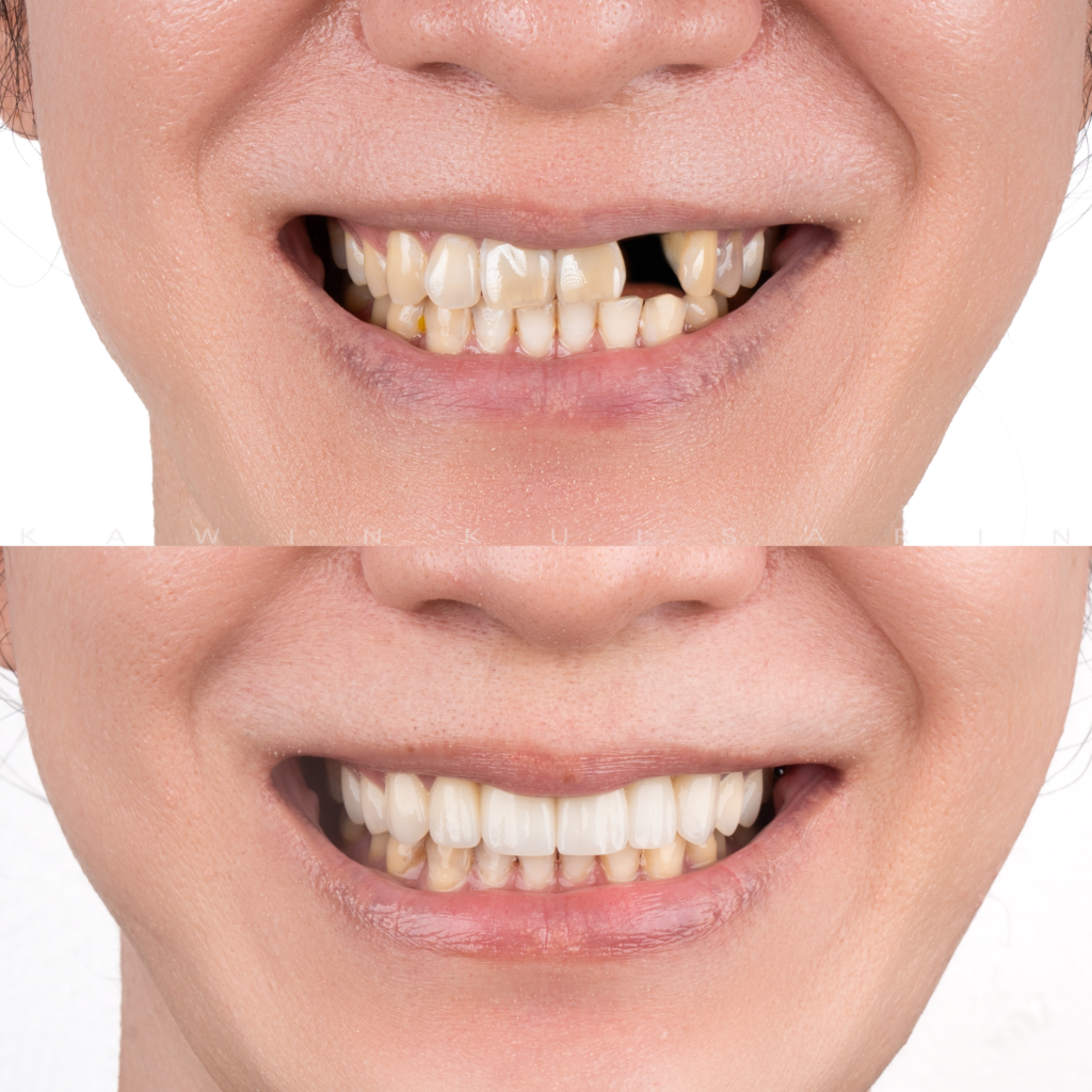 11 20 สำเนา