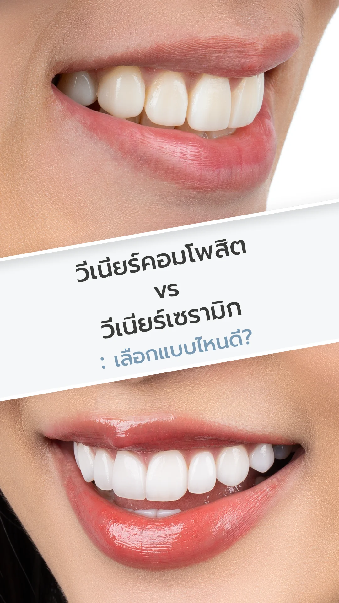 มือถือซุปเปอร์17
