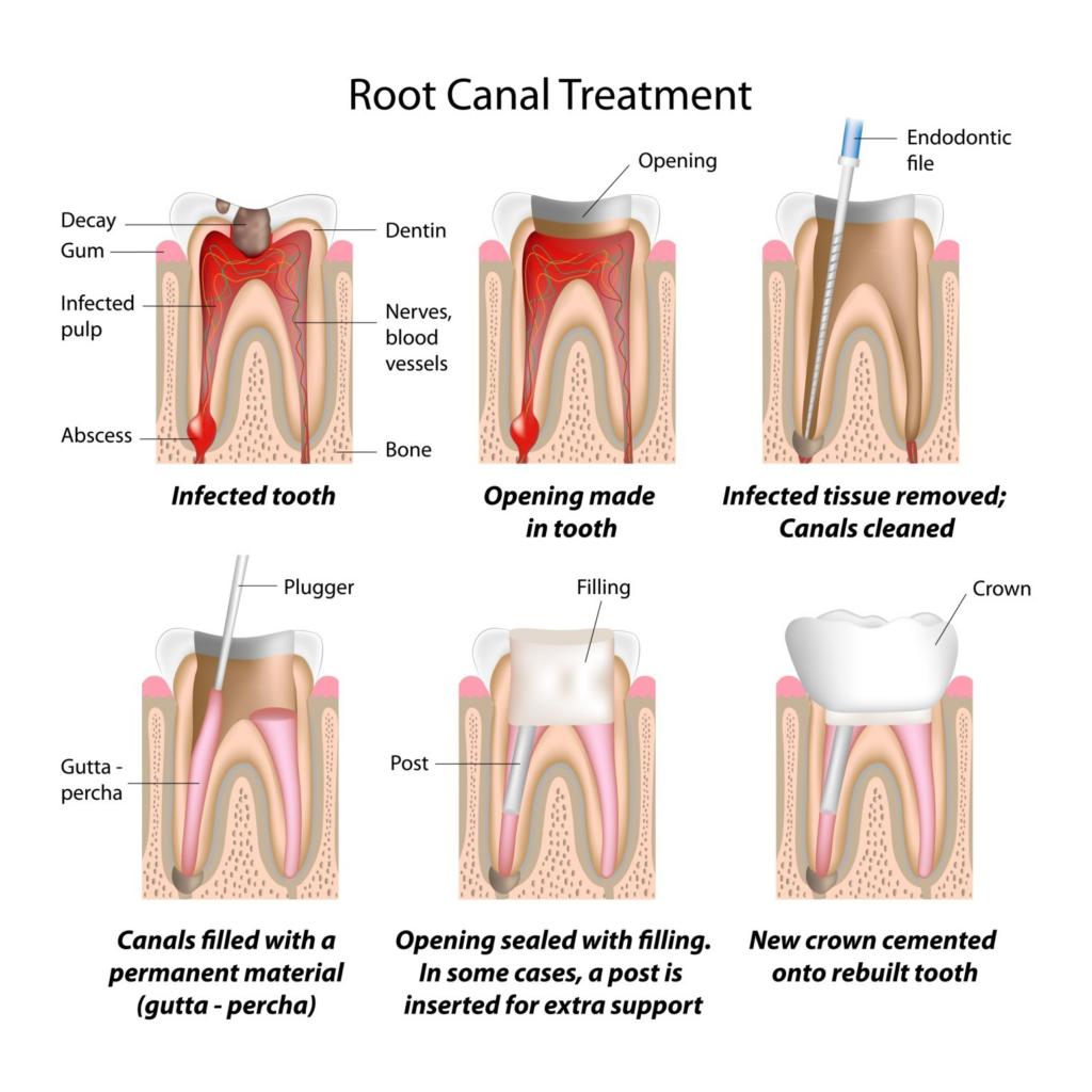 ยังไม่ยืนยัน 976506