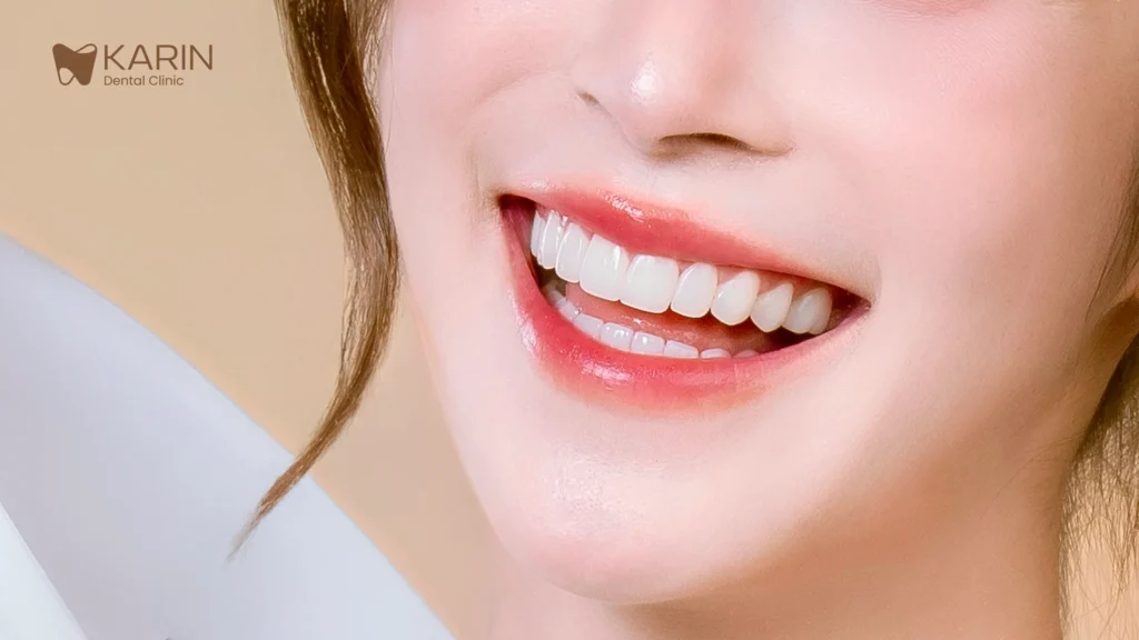 รอยยิ้มสวย